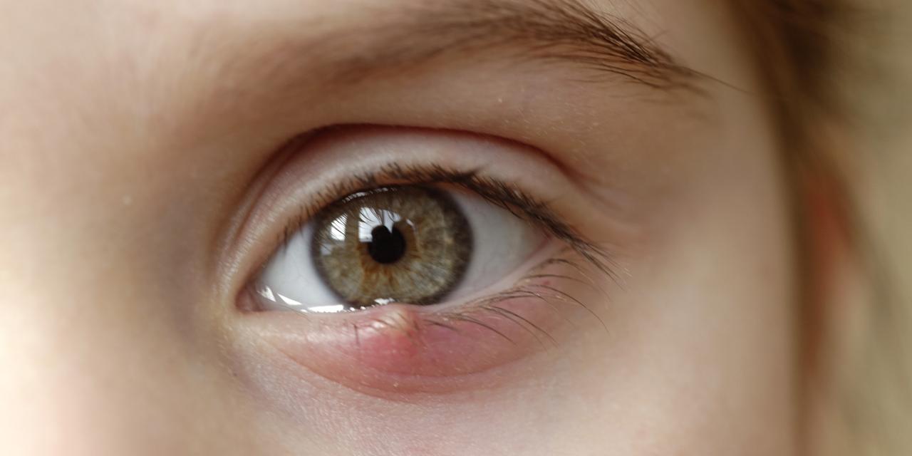 Nærbilde av et barns øye med sti.