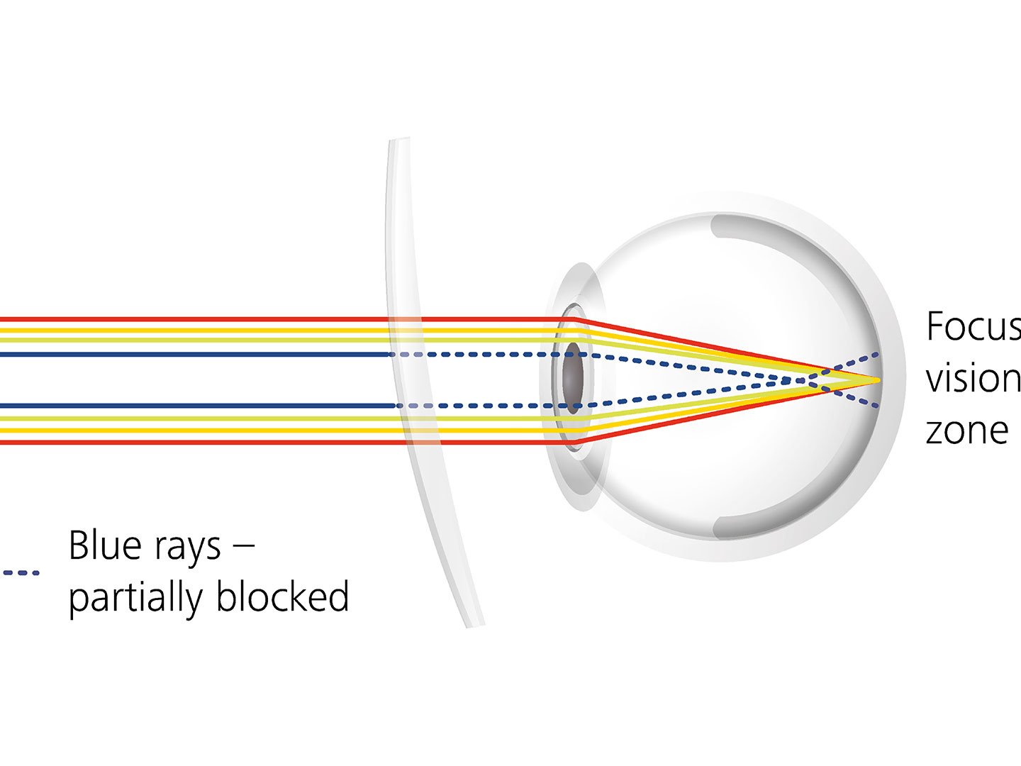 Visualisering av hvordan glassbelegg kan redusere blending ved delvis å blokkere blå stråler 